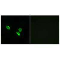 Immunofluorescence analysis of MCF-7 cells, using MRPS18C antibody.Rabbit anti-Human MRPS18C Polyclonal Antibody