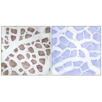 Immunohistochemistry analysis of paraffin-embedded human skeletal muscle tissue using MRPS18C antibody.Rabbit anti-Human MRPS18C Polyclonal Antibody