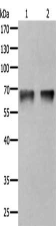 Gel: 10%SDS-PAGE, Lysate: 50 μg, Lane 1-2: Jurkat cells, 293T cells, Primary antibody: PRKCA Antibody(PRKCA Antibody) at dilution 1/100, Secondary antibody: Goat anti rabbit IgG at 1/8000 dilution, Exposure time: 40 secondsRabbit anti-Human PRKCA Polyclonal Antibody