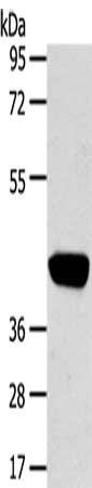 Gel: 8%SDS-PAGE, Lysate: 40 μg, Lane: Hepg2 cells, Primary antibody: PRSS50 Antibody(PRSS50 Antibody) at dilution 1/450, Secondary antibody: Goat anti rabbit IgG at 1/8000 dilution, Exposure time: 3 minutesRabbit anti-Human PRSS50 Polyclonal Antibody