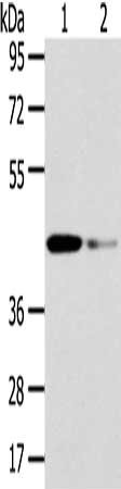 Gel: 8%SDS-PAGE, Lysate: 40 μg, Lane 1-2: Human fetal liver tissue and hela cell, Primary antibody: VPS37A Antibody(VPS37A Antibody) at dilution 1/200 dilution, Secondary antibody: Goat anti rabbit IgG at 1/8000 dilution, Exposure time: 15 secondsRabbit anti-Human VPS37A Polyclonal Antibody