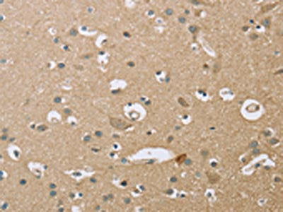 The image on the left is immunohistochemistry of paraffin-embedded Human brain  tissue using ECHS1 Antibody(ECHS1 Antibody) at dilution 1/35, on the right is treated with fusion protein. (Original magnification: ×200)Rabbit anti-Human ECHS1 Polyclonal Antibody