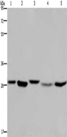 Gel: 8%SDS-PAGE, Lysate: 40 μg, Lane 1-5: 293T cells, MCF7 cells, PC3 cells, human fetal liver tissue, Hela cells, Primary antibody: ECHS1 Antibody(ECHS1 Antibody) at dilution 1/300, Secondary antibody: Goat anti rabbit IgG at 1/8000 dilution, Exposure time: 20 secondsRabbit anti-Human ECHS1 Polyclonal Antibody