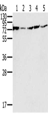Gel: 10%SDS-PAGE, Lysate: 40 μg, Lane 1-5: 293T cells, PC3 cells, hela cells, Jurkat cells, Raji cells, Primary antibody: NDUFS1 Antibody(NDUFS1 Antibody) at dilution 1/650, Secondary antibody: Goat anti rabbit IgG at 1/8000 dilution, Exposure time: 3 secondsRabbit anti-Human NDUFS1 Polyclonal Antibody