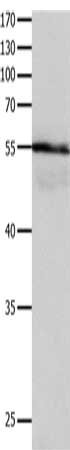 Gel: 10%SDS-PAGE, Lysate: 30 μg, Lane: Human brain glioma tissue, Primary antibody: HP Antibody(HP Antibody) at dilution 1/400, Secondary antibody: Goat anti rabbit IgG at 1/8000 dilution, Exposure time: 5 secondsRabbit anti-Human HP Polyclonal Antibody
