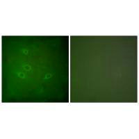 Immunofluorescence analysis of HeLa cells, using CARD6 antibody.