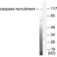 Western blot analysis of extracts from HeLa cells, using CARD6 antibody.