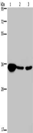 Gel: 8%SDS-PAGE, Lysate: 40 μg, Lane 1-3: Human testis tissue, 293T cells, A172 cells, Primary antibody: LZTFL1 Antibody(LZTFL1 Antibody) at dilution 1/300, Secondary antibody: Goat anti rabbit IgG at 1/8000 dilution, Exposure time: 20 seconds