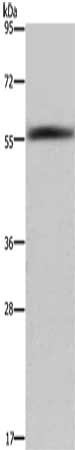 Gel: 6%SDS-PAGE, Lysate: 40 μg, Lane: Human fetal liver tissue, Primary antibody: FAR2 Antibody(FAR2 Antibody) at dilution 1/1000, Secondary antibody: Goat anti rabbit IgG at 1/8000 dilution, Exposure time: 40 secondsRabbit anti-Human FAR2 Polyclonal Antibody
