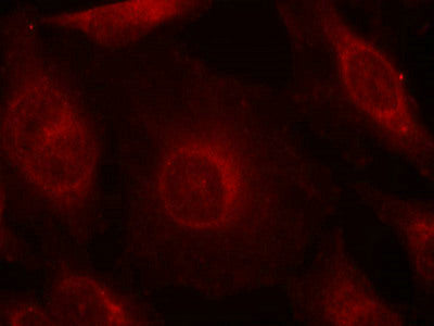 Immunofluorescence staining of methanol-fixed Hela cells using AKT1/AKT2/AKT3(phospho-Tyr315/316/312) Antibody.Rabbit anti-Human AKT1/AKT2/AKT3 Polyclonal Antibody