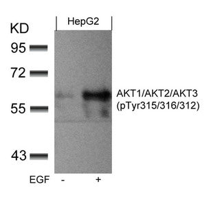 Western blot analysis of extracts from HepG2 cells untreated or treated with EGF using AKT1/AKT2/AKT3(phospho-Tyr315/316/312) Antibody.Rabbit anti-Human AKT1/AKT2/AKT3 Polyclonal Antibody