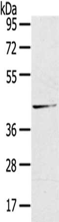 Gel: 8%SDS-PAGE,Lysate: 40 μg,,Primary antibody: HSD11B2 Antibody(HSD11B2 Antibody) at dilution 1/200 dilution,Secondary antibody: Goat anti rabbit IgG at 1/8000 dilution,Exposure time: 10 secondsRabbit anti-Human HSD11B2 Polyclonal Antibody