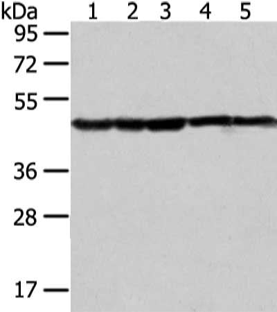 Gel: 8%SDS-PAGE, Lysate: 40 μg, Lane 1-5: Jurkat, Raji, hepg2, A431 and HT-29 cell, Primary antibody: UQCRC2 Antibody(UQCRC2 Antibody) at dilution 1/400 dilution, Secondary antibody: Goat anti rabbit IgG at 1/8000 dilution, Exposure time: 10 secondsRabbit anti-Human UQCRC2 Polyclonal Antibody
