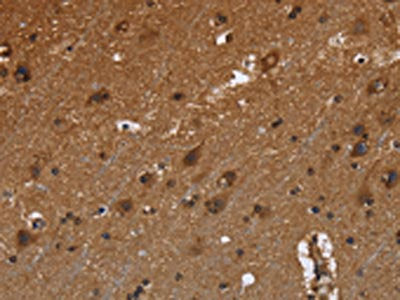 The image is immunohistochemistry of paraffin-embedded Human brain  tissue using FRK Antibody(FRK Antibody) at dilution 1/50. (Original magnification: ×200)Rabbit anti-Human FRK Polyclonal Antibody