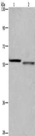 Gel: 6%SDS-PAGE, Lysate: 40 μg, Lane 1-2: K562 cells, A431 cells, Primary antibody: FRK Antibody(FRK Antibody) at dilution 1/1200, Secondary antibody: Goat anti rabbit IgG at 1/8000 dilution, Exposure time: 40 secondsRabbit anti-Human FRK Polyclonal Antibody