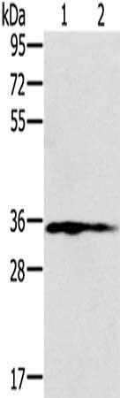 Gel: 8%SDS-PAGE, Lysate: 40 μg, Lane 1-2: Human placenta tissue, Human fetal liver tissue, Primary antibody: NIT1 Antibody(NIT1 Antibody) at dilution 1/250, Secondary antibody: Goat anti rabbit IgG at 1/8000 dilution, Exposure time: 2 minutesRabbit anti-Human NIT1 Polyclonal Antibody