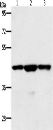 Gel: 10%SDS-PAGE, Lysate: 40 μg, Lane 1-3: Jurkat cells, hela cells, K562 cells, Primary antibody: MAP2K1 Antibody(MAP2K1 Antibody) at dilution 1/400, Secondary antibody: Goat anti rabbit IgG at 1/8000 dilution, Exposure time: 20 seconds