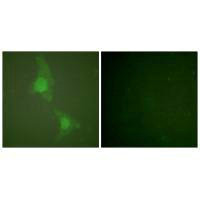 Immunofluorescence analysis of HeLa cells, using ADD1 (Ab-726) antibodyRabbit anti-Human ADD1 Polyclonal Antibody