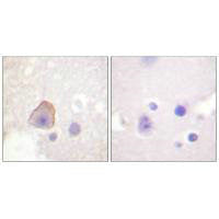 Immunohistochemical analysis of paraffin-embedded human brain tissue using ADD1 (Ab-726) antibody.Rabbit anti-Human ADD1 Polyclonal Antibody