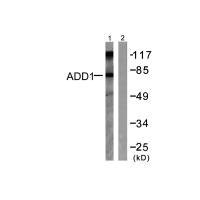 Western blot analysis of extracts from Hela cells treated with Forskolin (40nM, 30min), using ADD1 (Ab-726) antibody.