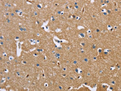 The image on the left is immunohistochemistry of paraffin-embedded Human brain  tissue using BSG Antibody(BSG Antibody) at dilution 1/60, on the right is treated with fusion protein. (Original magnification: ×200)