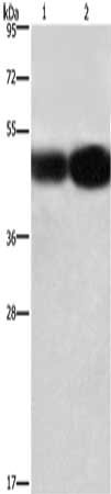 Gel: 8%SDS-PAGE, Lysate: 40 μg, Lane 1-2: A549 cells, 231 cells, Primary antibody: BSG Antibody(BSG Antibody) at dilution 1/430, Secondary antibody: Goat anti rabbit IgG at 1/8000 dilution, Exposure time: 12 seconds