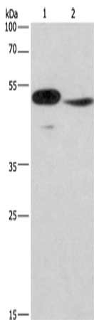 Gel: 8%SDS-PAGE, Lysate: 40 μg, Lane 1-2: Mouse panceas tissue, NIH/3T3 cells, Primary antibody: IRF9 Antibody(IRF9 Antibody) at dilution 1/380, Secondary antibody: Goat anti rabbit IgG at 1/8000 dilution, Exposure time: 1.5 minutes