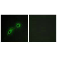 Immunofluorescence analysis of HeLa cells, using CAMK5 antibody.