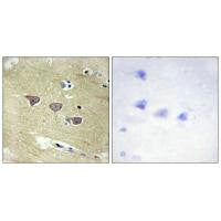 Immunohistochemistry analysis of paraffin-embedded human brain tissue using CAMK5 antibody.
