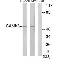 Western blot analysis of extracts from HepG2 cells and HUVEC cells, using CAMK5 antibody.