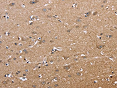 The image on the left is immunohistochemistry of paraffin-embedded Human brain tissue using the antibody Antibody) at dilution 1/50, on the right is treated with fusion protein. (Original magnification: ×200)