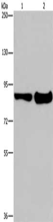 Gel: 6%SDS-PAGE, Lysate: 40 μg, Lane 1-2: Mouse lung tissue, Mouse liver tissue, Primary antibody: MAPRE3 Antibody(ECE1 Antibody) at dilution 1/1050, Secondary antibody: Goat anti rabbit IgG at 1/8000 dilution, Exposure time: 10 seconds
