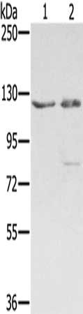 Gel: 6%SDS-PAGE, Lysate: 40 μg, Lane 1-2: 293T cells, hela cells, Primary antibody: SMC6 Antibody(SMC6 Antibody) at dilution 1/400, Secondary antibody: Goat anti rabbit IgG at 1/8000 dilution, Exposure time: 1 minuteRabbit anti-Human SMC6 Polyclonal Antibody