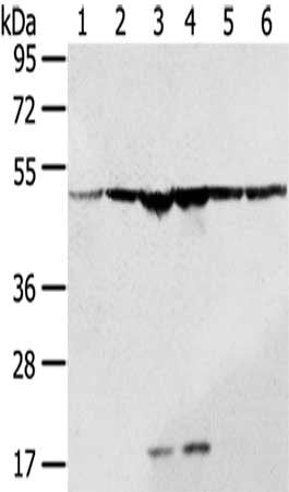 Gel: 8%SDS-PAGE,Lysate: 40 μg,Lane 1-6: A431 cells, SKOV3 cells, 231 cells, Jurkat cells, HepG2 cells, Hela cells,Primary antibody: DDX39B Antibody(DDX39B Antibody) at dilution 1/200 dilution,Secondary antibody: Goat anti rabbit IgG at 1/8000 dilution,Exposure time: 1 secondRabbit anti-Human DDX39B Polyclonal Antibody