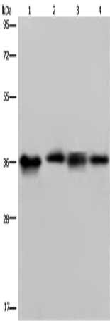 Gel: 8%SDS-PAGE, Lysate: 40 μg, Lane 1-4: HepG2 cells, 293T cells, human kidney cancer tissue, K562 cells, Primary antibody: F11R Antibody(F11R Antibody) at dilution 1/500, Secondary antibody: Goat anti rabbit IgG at 1/8000 dilution, Exposure time: 5 secondsRabbit anti-Human F11R Polyclonal Antibody