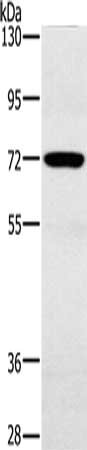 Gel: 6%SDS-PAGE, Lysate: 40 μg, Lane: Mouse heart tissue, Primary antibody: POU6F2 Antibody(POU6F2 Antibody) at dilution 1/200, Secondary antibody: Goat anti rabbit IgG at 1/8000 dilution, Exposure time: 30 secondsRabbit anti-Human POU6F2 Polyclonal Antibody