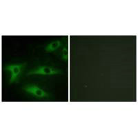 Immunofluorescence analysis of HeLa cells, using Collagen I α2 antibody.Rabbit anti-Human COL1A2 Polyclonal Antibody
