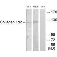 Western blot analysis of extracts from 293 cells and HeLa cells, using Collagen I α2 antibody.Rabbit anti-Human COL1A2 Polyclonal Antibody