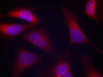 Immunofluorescence staining of methanol-fixed Hela cells using PKR(Phospho-Thr446) Antibody.Rabbit anti-Human EIF2AK2 Polyclonal Antibody