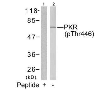 Western blot analysis of extracts from K562 cells using PKR(Phospho-Thr446) Antibody(Lane 2) and the same antibody preincubated with blocking peptide(Lane1).Rabbit anti-Human EIF2AK2 Polyclonal Antibody