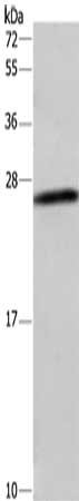 Gel: 10%SDS-PAGE, Lysate: 40 μg, Lane: A549 cells, Primary antibody: DCTN6 Antibody(DCTN6 Antibody) at dilution 1/450, Secondary antibody: Goat anti rabbit IgG at 1/8000 dilution, Exposure time: 5 minutesRabbit anti-Human DCTN6 Polyclonal Antibody