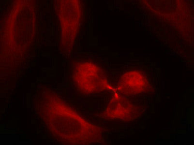 Immunofluorescence staining of methanol-fixed Hela cells using syk(Ab-323) Antibody.Rabbit anti-Human SYK Polyclonal Antibody