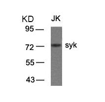 Western blot analysis of extracts from JK cells using syk(Ab-323) Antibody.Rabbit anti-Human SYK Polyclonal Antibody