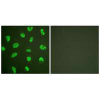 Immunofluorescence analysis of HeLa cells, treated with Forskolin (40nM, 30mins), using DNA-PK antibody.Rabbit anti-Human PRKDC Polyclonal Antibody
