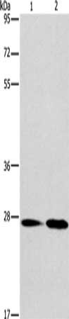 Gel: 8%SDS-PAGE, Lysate: 40 μg, Lane 1-2: Mouse kidney tissue, Mouse liver tissue, Primary antibody: NAT8 Antibody(NAT8 Antibody) at dilution 1/237.5, Secondary antibody: Goat anti rabbit IgG at 1/8000 dilution, Exposure time: 20 secondsRabbit anti-Human NAT8 Polyclonal Antibody