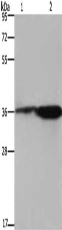 Gel: 8%SDS-PAGE, Lysate: 40 μg, Lane 1-2: 293T cells, mouse brain tissue, Primary antibody: FCAR Antibody(FCAR Antibody) at dilution 1/550, Secondary antibody: Goat anti rabbit IgG at 1/8000 dilution, Exposure time: 10 secondsRabbit anti-Human FCAR Polyclonal Antibody