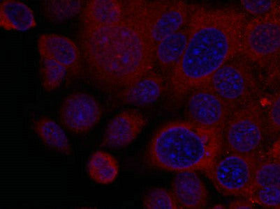 Immunofluorescence staining of methanol-fixed MCF7 cells using p70 S6 Kinase(Ab-411) Antibody.Rabbit anti-Human RPS6KB1 Polyclonal Antibody