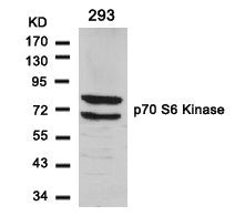 Western blot analysis of extracts from 293 cells using p70 S6 Kinase(Ab-411) Antibody.Rabbit anti-Human RPS6KB1 Polyclonal Antibody