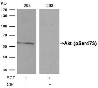 Western blot analysis of extracts from 293 cells, treatedwith EGF or calf intestinal phosphatase (CIP), using Akt(Phospho-Ser473) Antibody.Rabbit anti-Human AKT1 Polyclonal Antibody