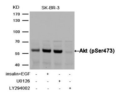 Western blot analysis of extracts from SK-BR-3 cells,treated with insulin and EGF, and pretreated with U0126and LY294002 cells using Akt (Phospho-Ser473) Antibody.Rabbit anti-Human AKT1 Polyclonal Antibody